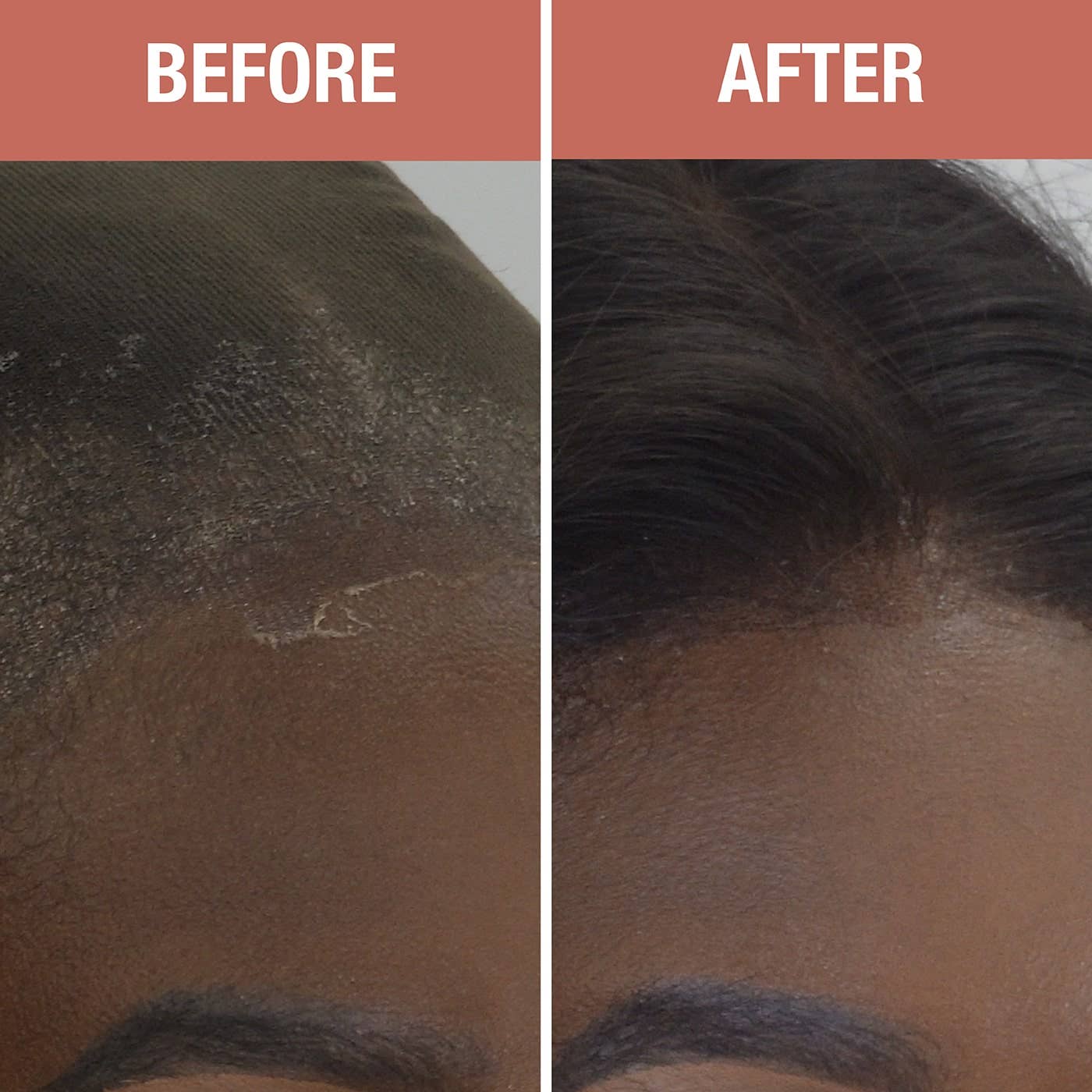 Wonder Lace Bond GLUELESS - Lace Holding Spray
